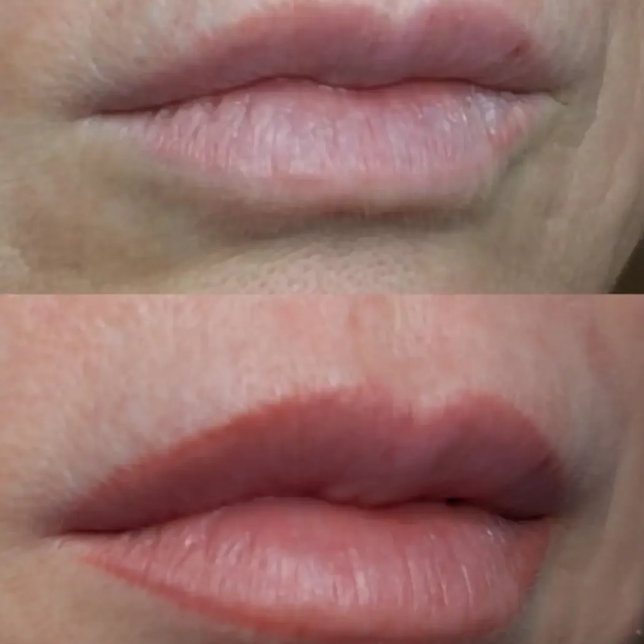 lips before and after permanent makeup